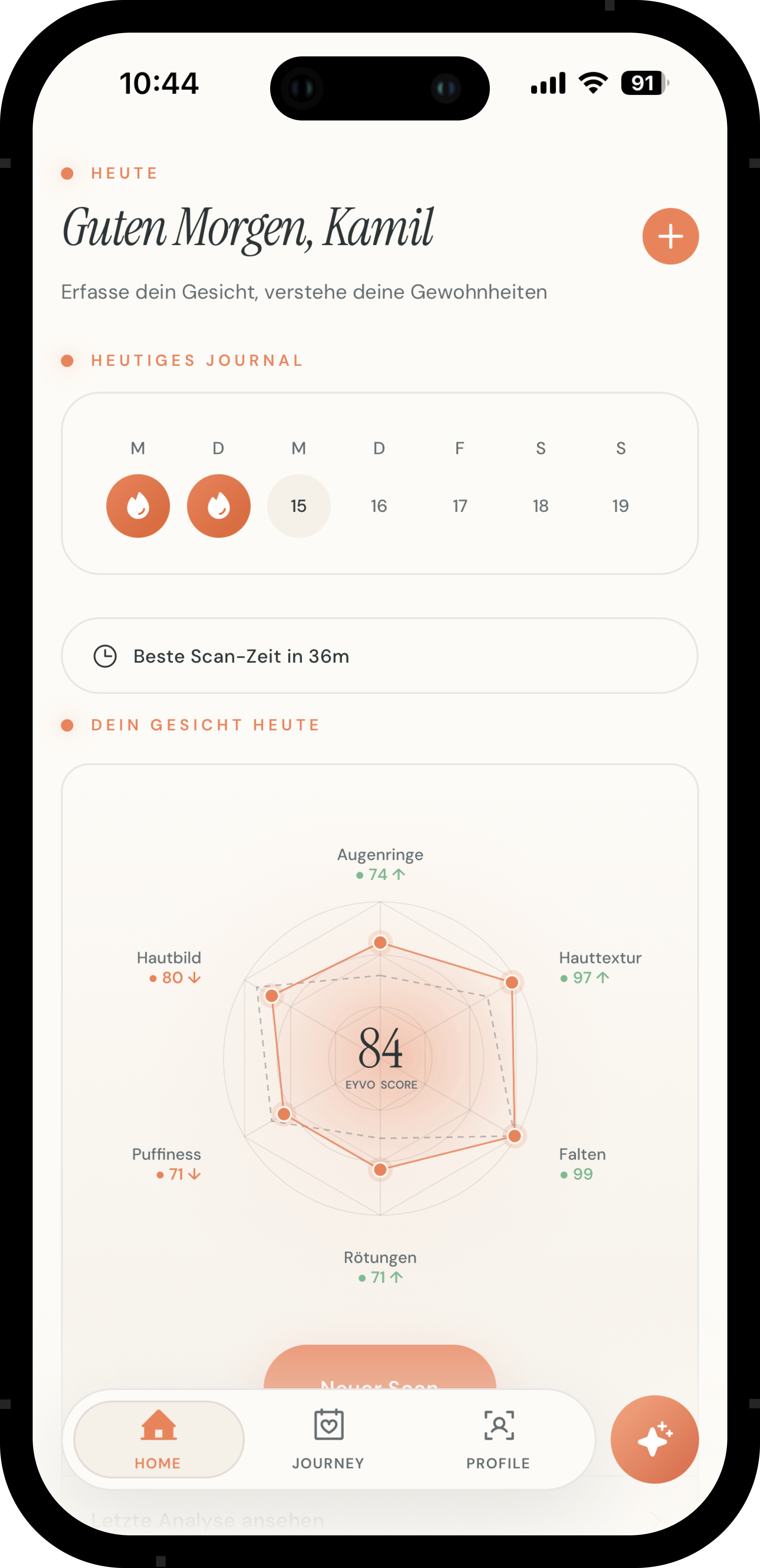 EYVO Score screen